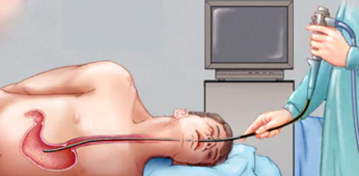 Upper GI Endoscopy
                           